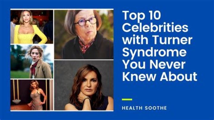 10 Famous People With Turner Syndrome: Inspiring Stories Of Resilience