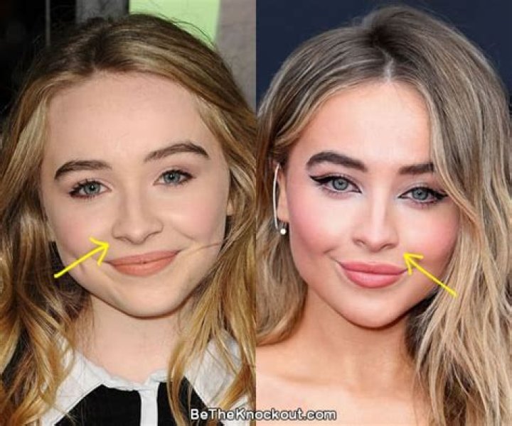Did Sabrina Carpenter's Nose Job Change Her Look?