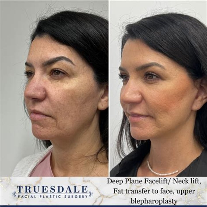 Did Yanic Truesdale Transform His Appearance?