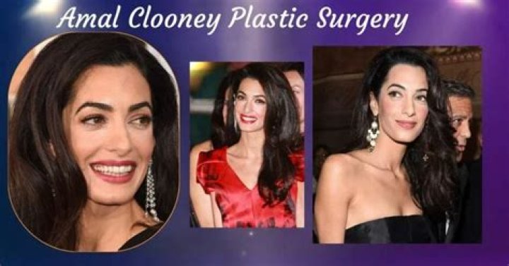Amal Clooney's Plastic Surgery Journey Explored