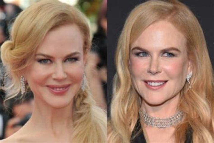 The Truth Uncovered: Cosmetic Surgery Rumors Surrounding Nicole Kidman