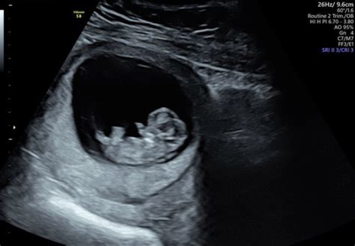 Is 10 weeks too late for first prenatal visit?