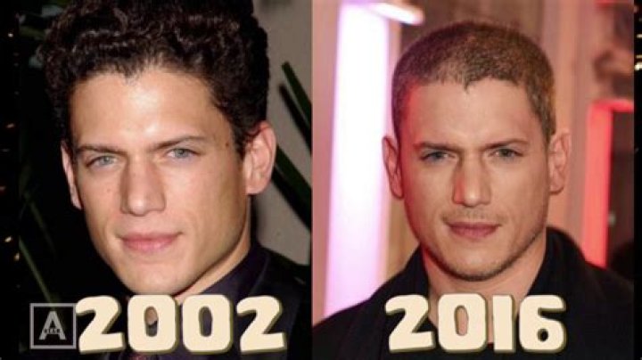 Is Wentworth Miller Bald? Health Update And Hair Loss Journey