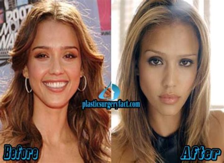 Unveiling The Secrets Of Jessica Alba's Nose Job: A Journey Of Transformation