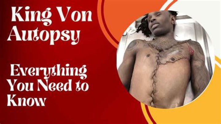 Graphic Warning: King Von Autopsy Photo Reveals Tragic Aftermath