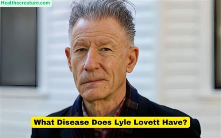 Unraveling The Enigma Of Lyle Lovett's Illness: A Journey Of Discovery