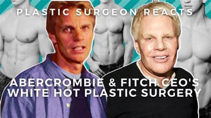 Plastic Surgery Secrets Of Abercrombie's Former CEO