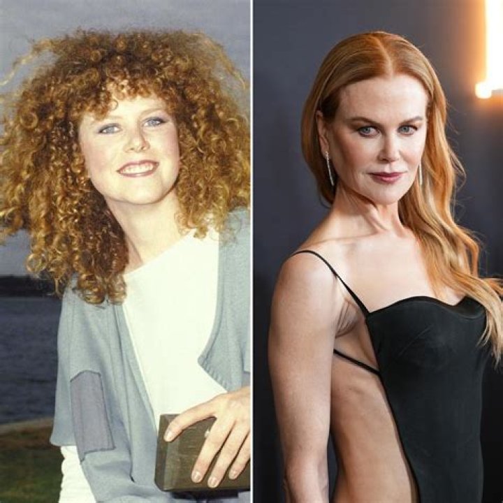 The Evolution Of Nicole Kidman's Appearance: A Look At Her Plastic Surgery Journey