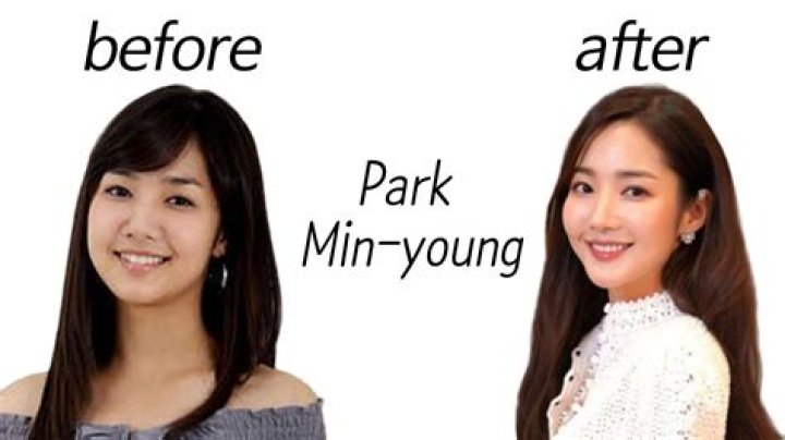 Unraveling Park Min Young's Plastic Surgery Journey: A Comprehensive Guide