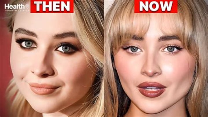 Savrina Carpenter's Rumored Plastic Surgery: Fact Or Fiction?