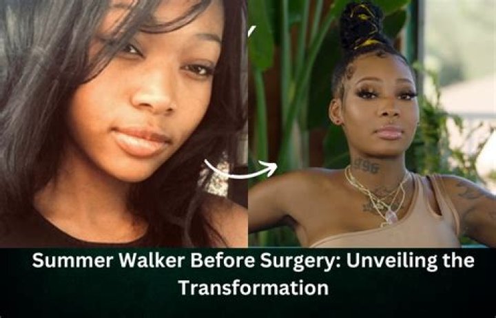 Summer Walker Before Surgery Unveiled