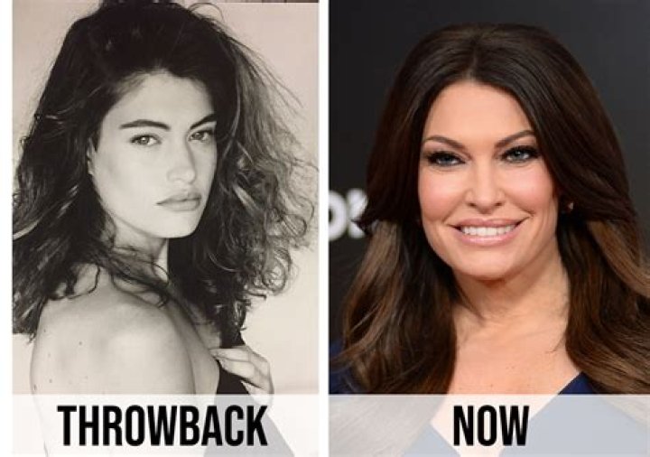Kimberly Guilfoyle's Facial Transformation: Uncovering Its Evolution