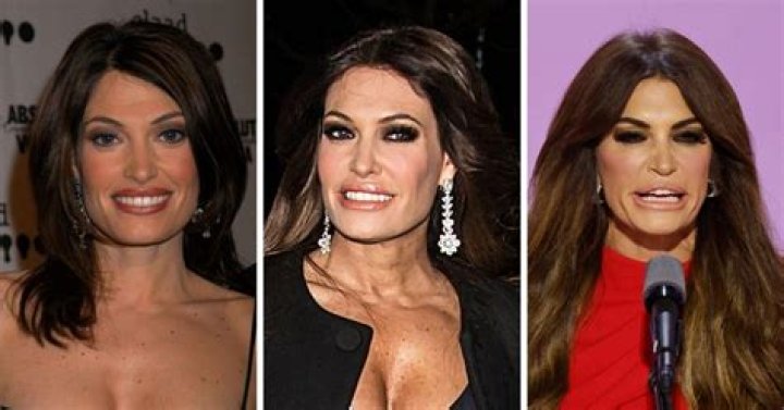 Kimberley Guilfoyle's Transformation: What Has She Done To Her Face?