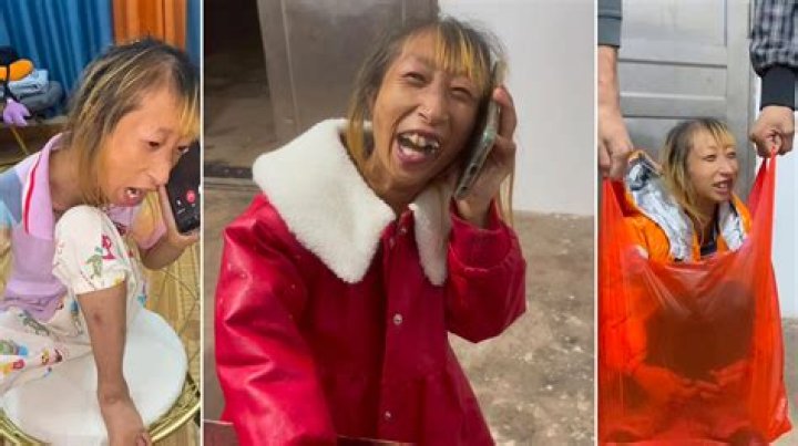 Understanding Xiao Xiao Disability AVM